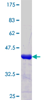 ab153412 on a 12.5% SDS-PAGE stained with Coomassie Blue.