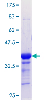ab158446 on a 12.5% SDS-PAGE stained with Coomassie Blue.