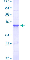 ab158448 on a 12.5% SDS-PAGE stained with Coomassie Blue.