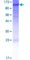 ab152873 on a 12.5% SDS-PAGE stained with Coomassie Blue.