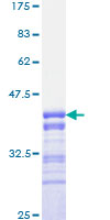 ab158451 on a 12.5% SDS-PAGE stained with Coomassie Blue.