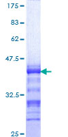 ab153575 on a 12.5% SDS-PAGE stained with Coomassie Blue.