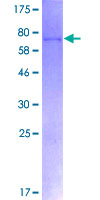 ab162380 on a 12.5% SDS-PAGE stained with Coomassie Blue.
