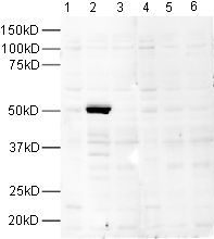 All lanes : Anti-FOXP3 antibody ( ab10901 ) at 0.4 µg/ml Lane 1 : 20µg HEK 293 lysate Lane 2 : 20µg HEK 293 lysate over expressing human FOXP3 Lane 3 : 20µg HEK 293 lysate over expressing mouse FOXP3 Lane 4 : 20µg HEK 293 lysate with Human FOXP3 peptide (ab16809) at 1 µg/ml Lane 5 : 20µg HEK 293 lysate over expressing human FOXP3 with Human FOXP3 peptide (ab16809) at 1 µg/ml Lane 6 : 20µg HEK 293 lysate over expressing mouse FOXP3 with Human FOXP3 peptide (ab16809) at 1 µg/ml Secondary Lanes 4 - 6 : Goat Anti-Rabbit IgG H&L (HRP) ( ab6721 ) at 0.2 µg/ml Performed under reducing conditions. Predicted band size : 47 kDa Exposure time : 1 minute A no primary control lane showed no bands.
