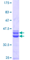 ab165095 on a 12.5% SDS-PAGE stained with Coomassie Blue.