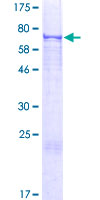 ab163127 on a 12.5% SDS-PAGE stained with Coomassie Blue.