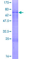 ab158449 on a 12.5% SDS-PAGE stained with Coomassie Blue.
