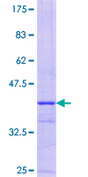 ab158450 on a 12.5% SDS-PAGE stained with Coomassie Blue.