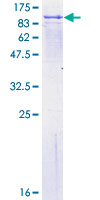 ab160188 on a 12.5% SDS-PAGE stained with Coomassie Blue.