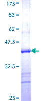 ab160189 on a 12.5% SDS-PAGE stained with Coomassie Blue.