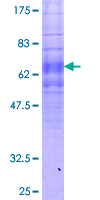 ab158465 on a 12.5% SDS-PAGE stained with Coomassie Blue.