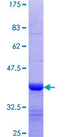 ab153168 on a 12.5% SDS-PAGE stained with Coomassie Blue.