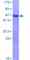 ab165496 on a 12.5% SDS-PAGE stained with Coomassie Blue.