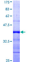 ab161781 on a 12.5% SDS-PAGE stained with Coomassie Blue.