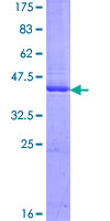 ab164448 on a 12.5% SDS-PAGE stained with Coomassie Blue.