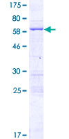 ab164449 on a 12.5% SDS-PAGE stained with Coomassie Blue.