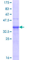 ab158468 on a 12.5% SDS-PAGE stained with Coomassie Blue.