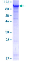 ab165737 on a 12.5% SDS-PAGE stained with Coomassie Blue.