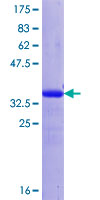 ab153159 on a 12.5% SDS-PAGE stained with Coomassie Blue.