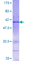 ab160921 on a 12.5% SDS-PAGE stained with Coomassie Blue.