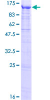 ab163409 on a 12.5% SDS-PAGE stained with Coomassie Blue.