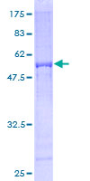 ab163832 on a 12.5% SDS-PAGE stained with Coomassie Blue.