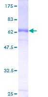ab161768 on a 12.5% SDS-PAGE stained with Coomassie Blue.