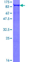 ab152933 on a 12.5% SDS-PAGE stained with Coomassie Blue.