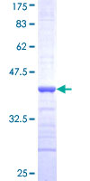 ab152934 on a 12.5% SDS-PAGE stained with Coomassie Blue.