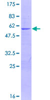 ab160271 on a 12.5% SDS-PAGE stained with Coomassie Blue.