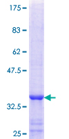 ab158475 on a 12.5% SDS-PAGE stained with Coomassie Blue.