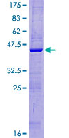 ab165435 on a 12.5% SDS-PAGE stained with Coomassie Blue.