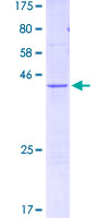 ab163943 on a 12.5% SDS-PAGE stained with Coomassie Blue.