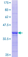 ab163944 on a 12.5% SDS-PAGE stained with Coomassie Blue.