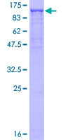 ab159045 on a 12.5% SDS-PAGE stained with Coomassie Blue.