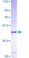 ab164654 on a 12.5% SDS-PAGE stained with Coomassie Blue.