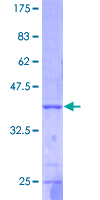 ab158477 on a 12.5% SDS-PAGE stained with Coomassie Blue.