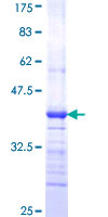 ab158479 on a 12.5% SDS-PAGE stained with Coomassie Blue.