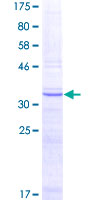 ab158481 on a 12.5% SDS-PAGE stained with Coomassie Blue.