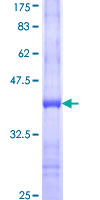 ab161111 on a 12.5% SDS-PAGE stained with Coomassie Blue.