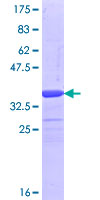 ab162805 on a 12.5% SDS-PAGE stained with Coomassie Blue.