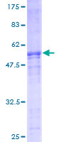 ab164031 on a 12.5% SDS-PAGE stained with Coomassie Blue.