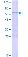 ab164533 on a 12.5% SDS-PAGE stained with Coomassie Blue.