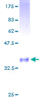 ab158543 on a 12.5% SDS-PAGE stained with Coomassie Blue.