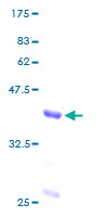 ab158536 on a 12.5% SDS-PAGE stained with Coomassie Blue.