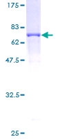 ab153115 on a 12.5% SDS-PAGE stained with Coomassie Blue.
