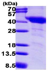 15% SDS-PAGE analysis of 3 µg ab113585.