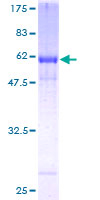 12.5% SDS-PAGE analysis of ab132215 stained with Coomassie Blue.