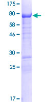 ab160625 on a 12.5% SDS-PAGE stained with Coomassie Blue.