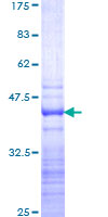ab166010 on a 12.5% SDS-PAGE stained with Coomassie Blue.